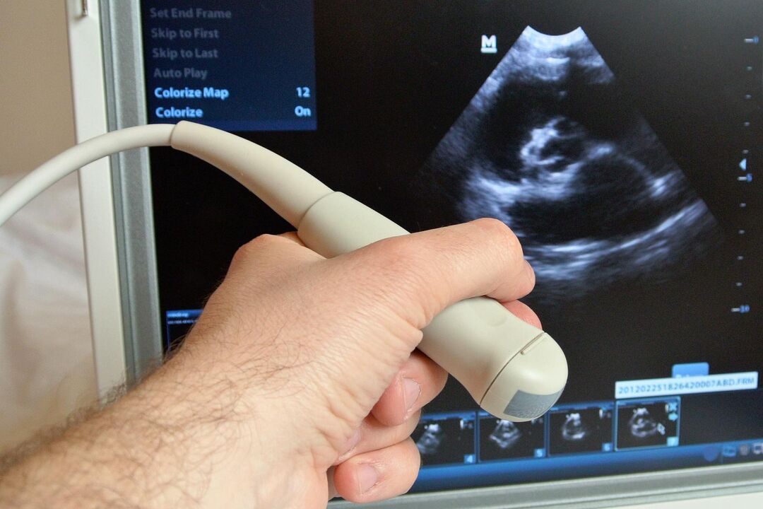 Ang ultrasound makatabang sa pag-diagnose sa congestive prostatitis sa usa ka lalaki