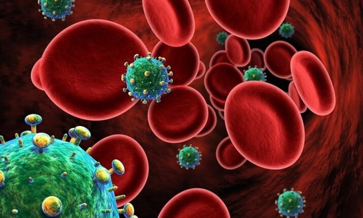 mga virus sa lawas ingon usa ka hinungdan sa pag-uswag sa prostatitis